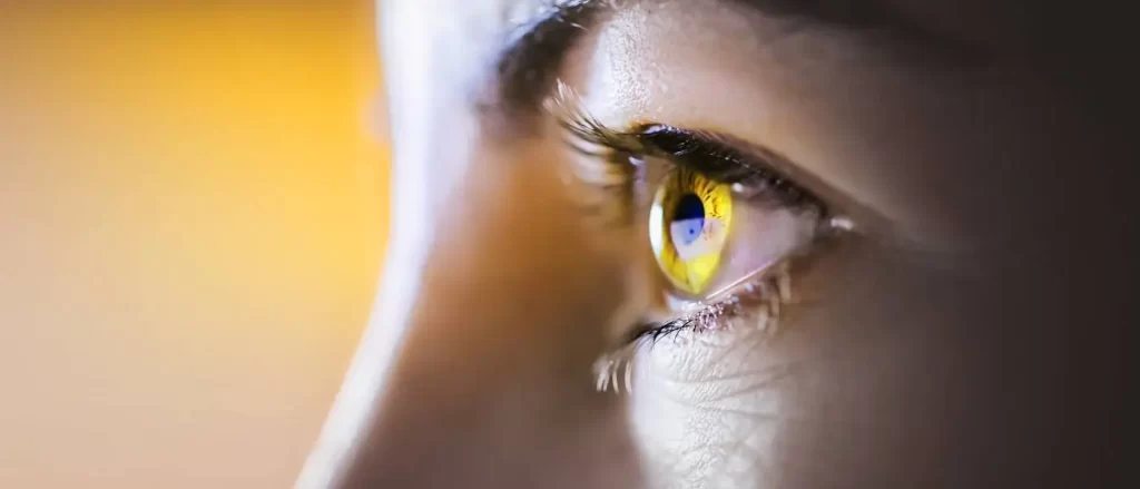 Treatment Of Eye Bleeds in Hemophilia