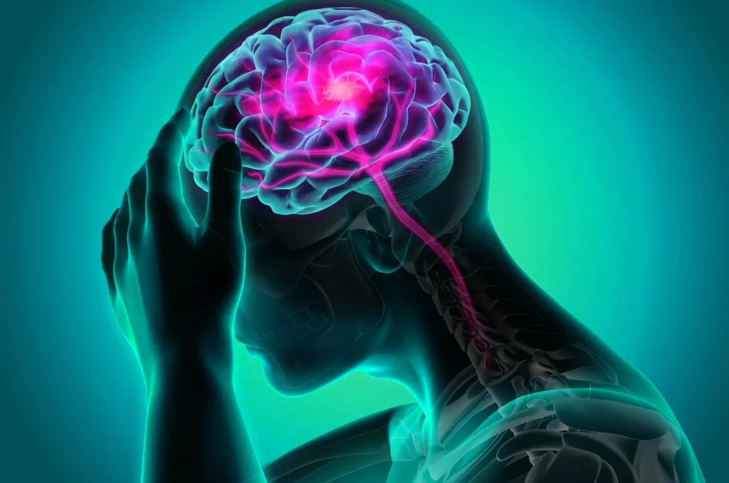 Intracranial Pressure